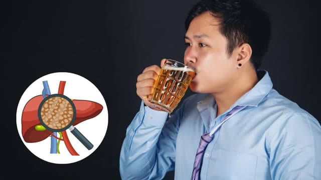 Nguyên nhân xơ gan thường gặp và giải pháp bảo vệ lá gan