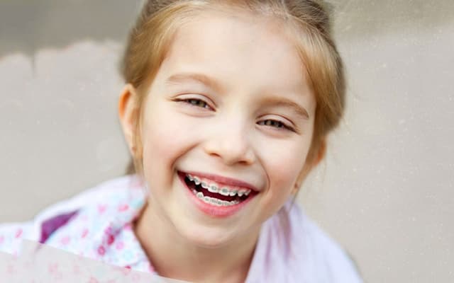 Giải đáp: Khi nào thì niềng răng không nhổ răng