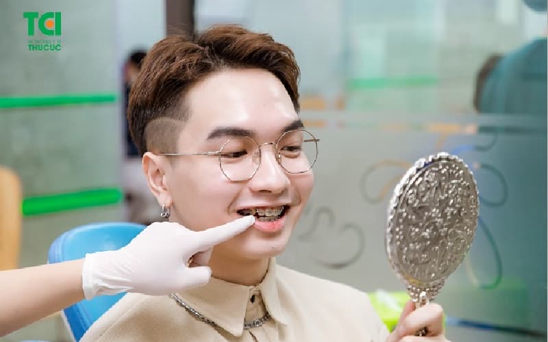 niềng răng không nhổ răng khi nào