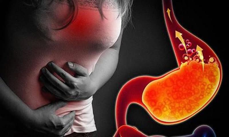 Trào ngược là một nguyên nhân phổ biến gây nóng rát ngực ỏ bên trái.