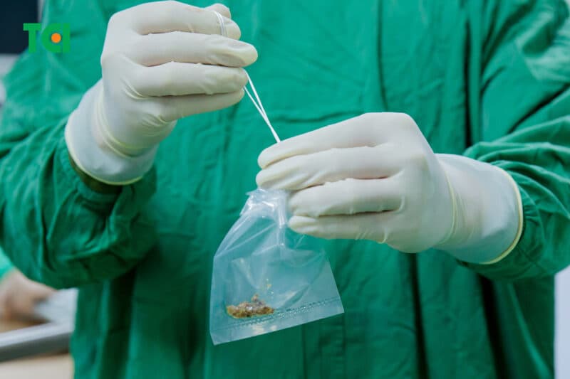 Tắc nghẽn đường tiết niệu – nguyên nhân phổ biến hàng đầu gây ứ nước thận ở người lớn