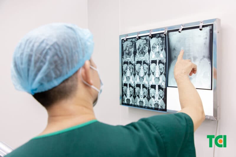 Sỏi tiết niệu và cách điều trị tại từng vị trí phổ biến