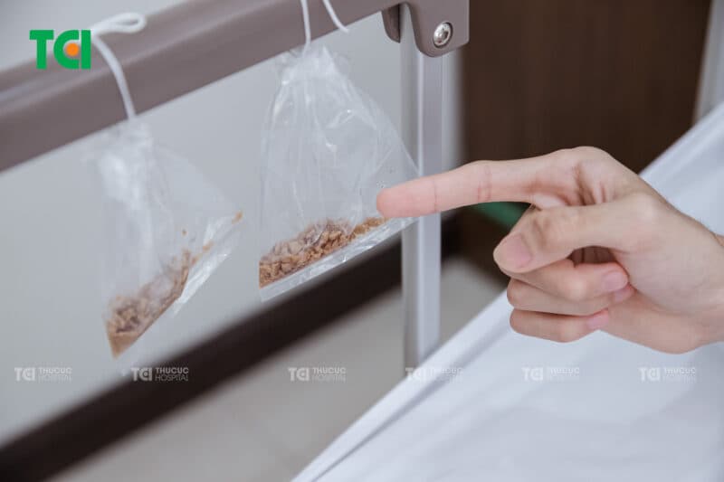 Sỏi tiết niệu là gì và vì sao lại hình thành?