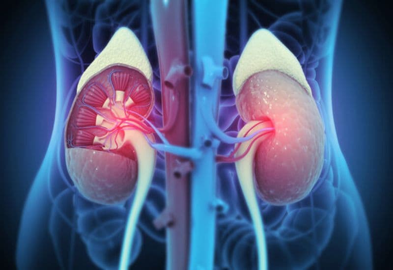 Hậu quả của giãn đài bể thận: Những biến chứng không thể xem nhẹ