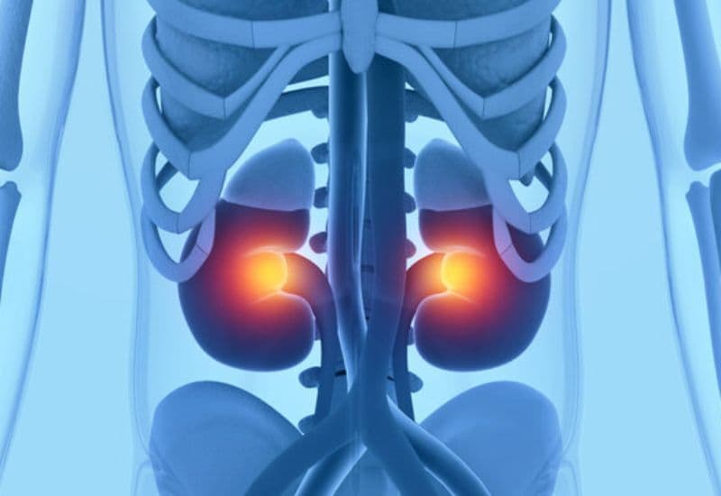 Bệnh thận ứ nước có nguy hiểm không nếu chỉ bị 1 bên