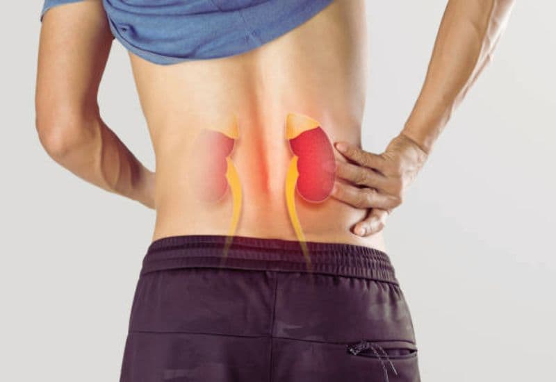 Tiến triển của bệnh thận ứ nước nếu không điều trị