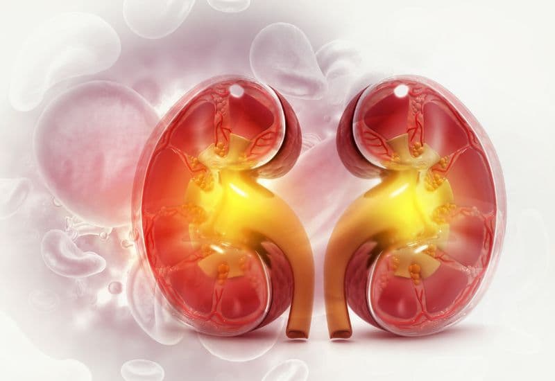 Thận ứ nước và phân loại theo giai đoạn