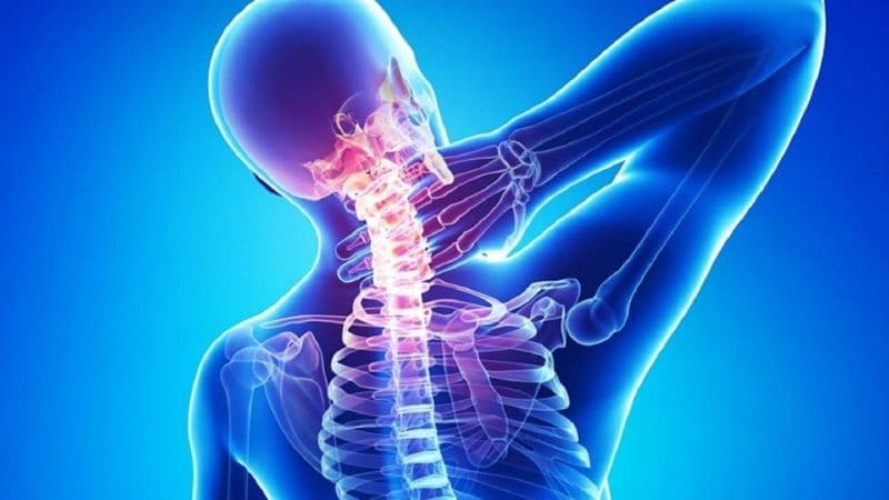 Thoái hóa cột sống cổ là bệnh gì?