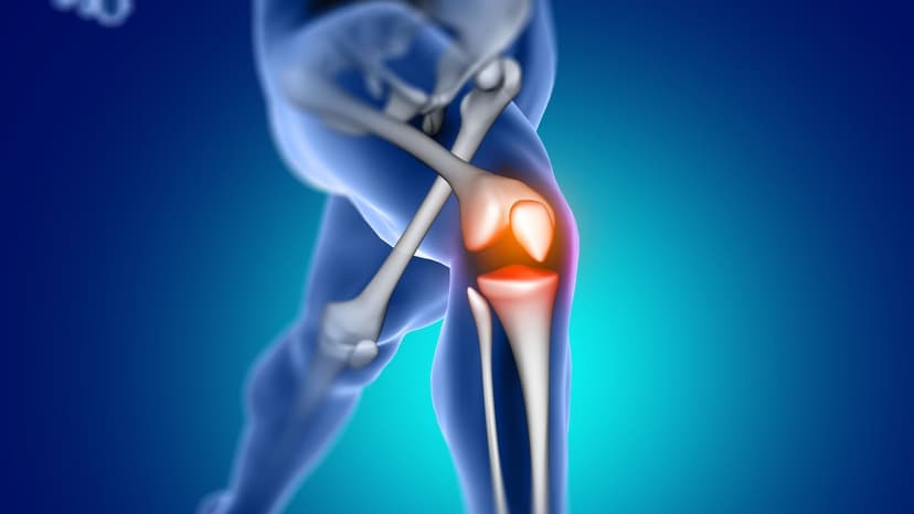 Thoái hóa sụn khớp gối và nguy cơ tàn phế nếu không điều trị