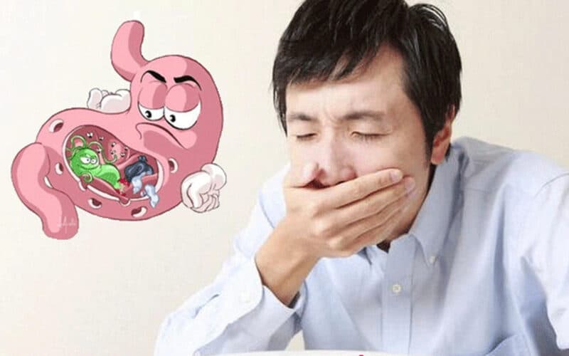 Trào ngược dạ dày gây nấc là triệu chứng khá quen thuộc với nhiều người.