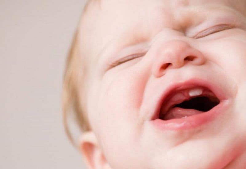 Khi trẻ mọc răng hoặc vệ sinh răng miệng chưa tốt, cần trị sưng lợi kịp thời để tránh đau nhức