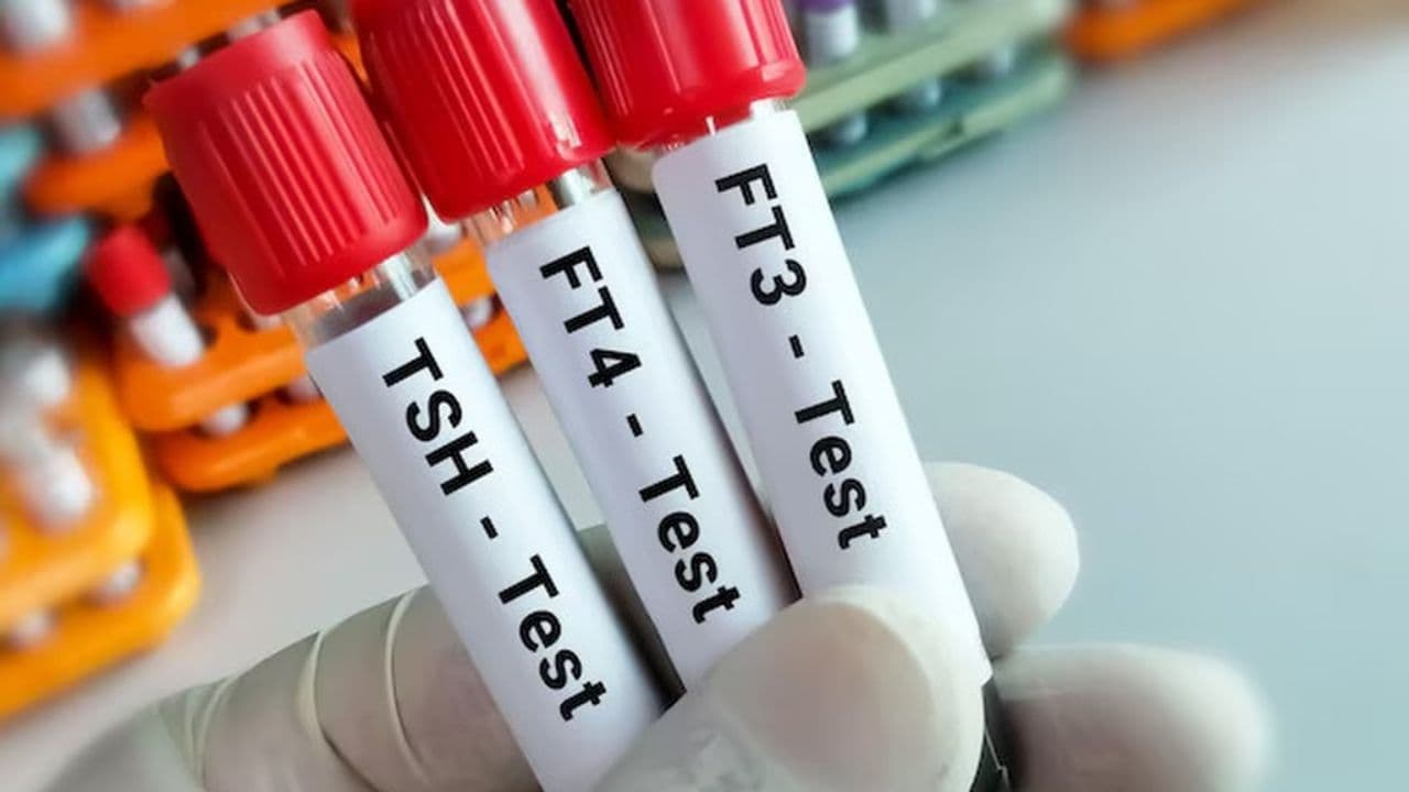 Xét nghiệm chức năng tuyến giáp (TSH, T3, T4)