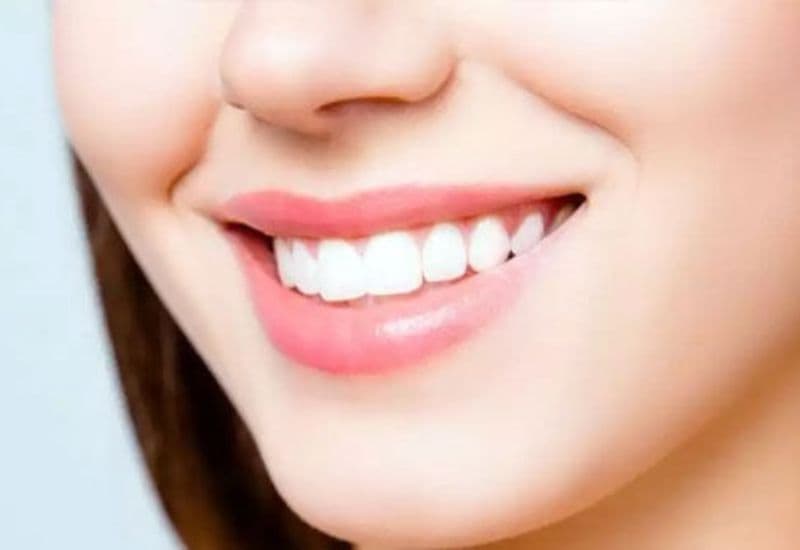 Trồng răng sứ mang lại nụ cười đều đẹp, tăng sự tự tin trong giao tiếp.