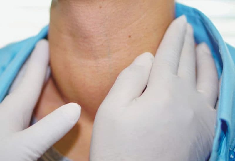 Hiểu đúng về u nang tuyến giáp lành tính