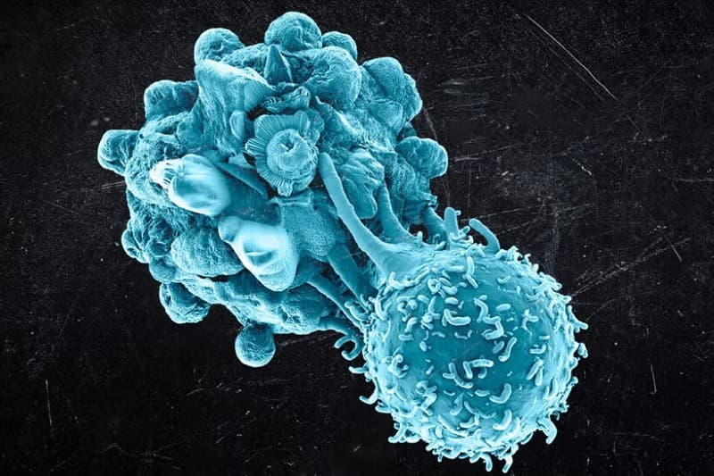 ung thư biểu mô và điều cần chú ý