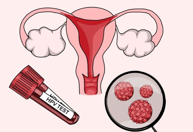 HPV gây ra ung thư cổ tử cung như thế nào?