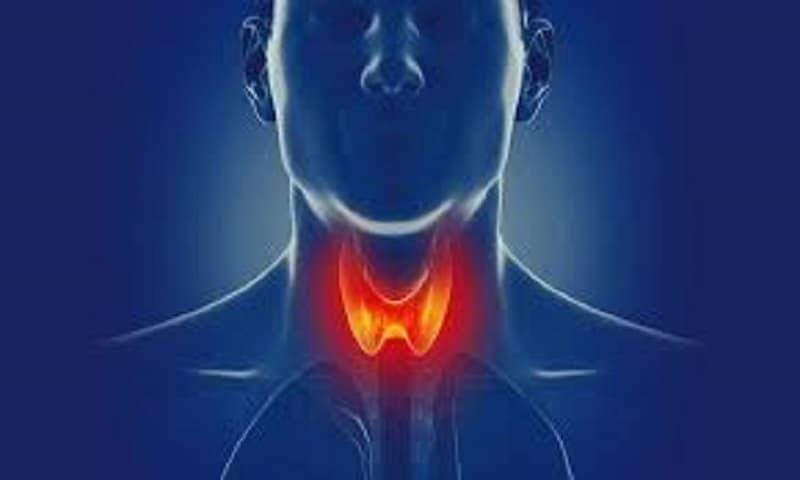 Đây là biến chứng hiếm nhưng cực kỳ nguy hiểm, xảy ra khi hormone tuyến giáp tăng vọt đột ngột