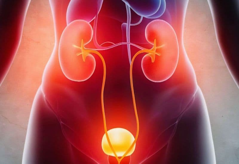 Những bệnh lý nguy hiểm gây thận ứ nước nếu không điều trị triệt để