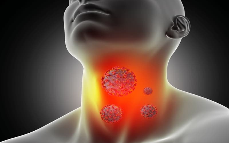 Cảnh báo viêm họng cấp