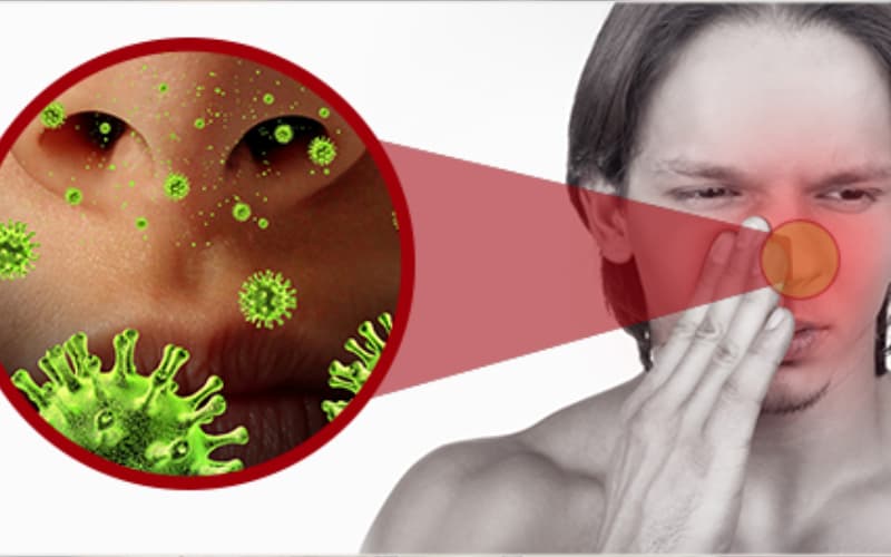 Viêm mũi xoang nguy hiểm không