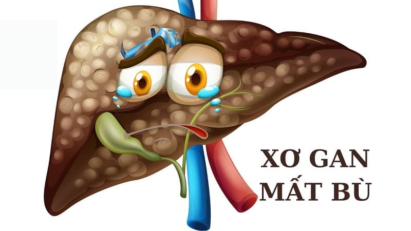 Xơ gan mất bù là gì?