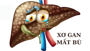 Những lưu ý quan trọng khi điều trị xơ gan mất bù