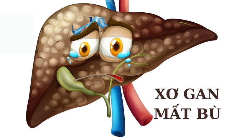 Những lưu ý quan trọng khi điều trị xơ gan mất bù