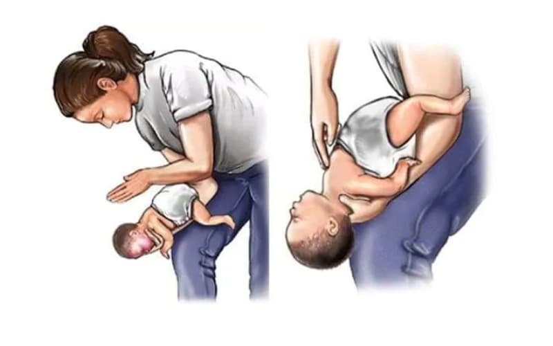 Cách xử trí khi hóc dị vật ở trẻ