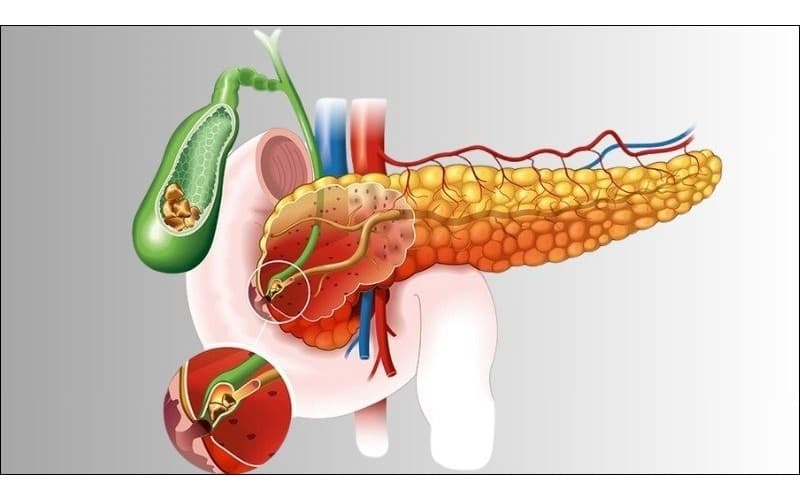 Ung thư đường mật tại rốn gan (còn gọi là u klatskin đường mật) là một dạng ung thư ác tính khởi phát từ biểu mô của hệ thống đường mật