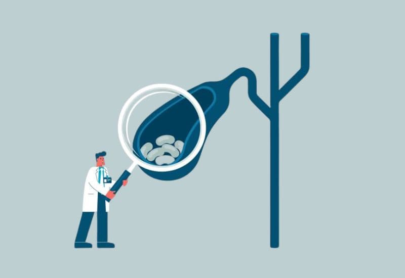 Các bệnh lý túi mật thường gặp cần lưu ý