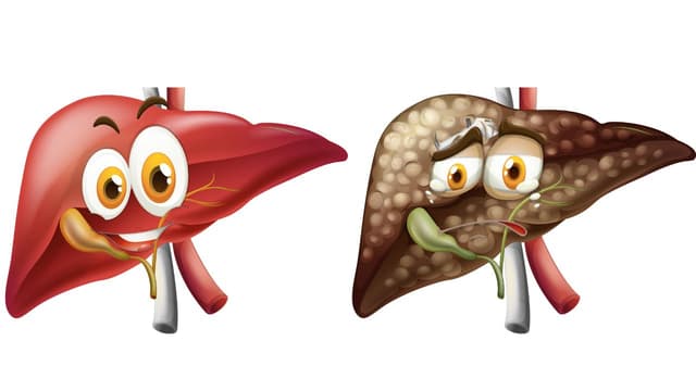 Bệnh xơ gan: Các giai đoạn và cách điều trị