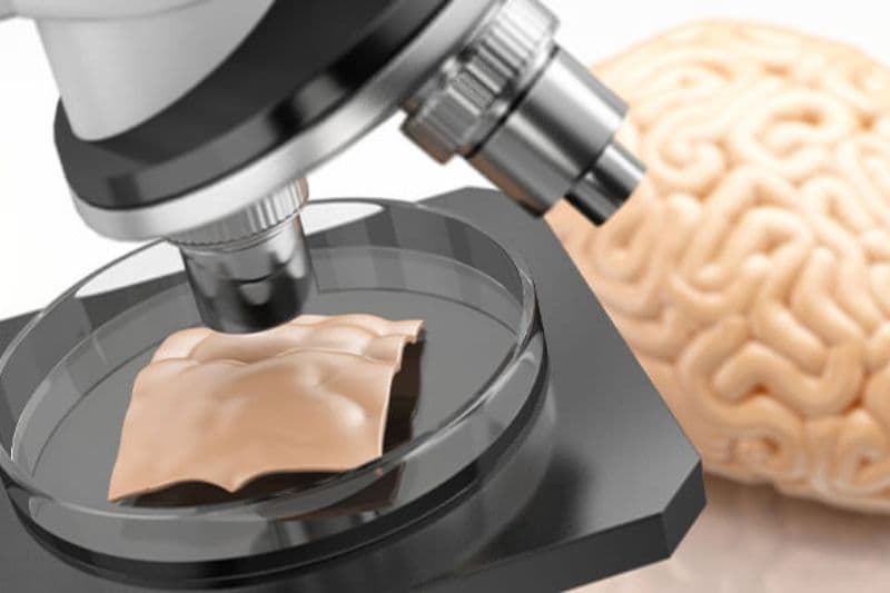 sinh thiết u não thường gặp 