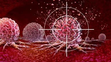 Chữa bệnh ung thư vú bằng liệu pháp trúng đích