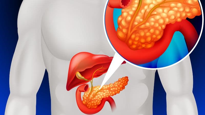 Cơ chế đái tháo đường type 1