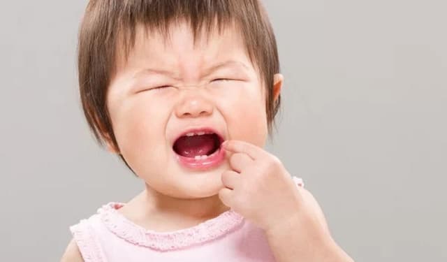 Dấu hiệu nhận biết sớm khi em bé sâu răng và cách điều trị kịp thời