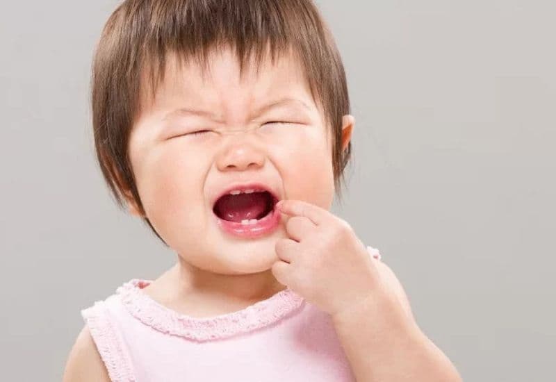 Tình trạng em bé sâu răng đang trở thành mối lo ngại khiến nhiều bậc phụ huynh đặc biệt quan tâm hiện nay.