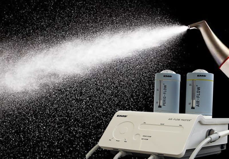 Thổi cát chủ yếu loại bỏ mảng bám mềm, vì vậy nha sĩ thường kết hợp thêm lấy cao răng siêu âm hoặc thủ công để đảm bảo hiệu quả toàn diện