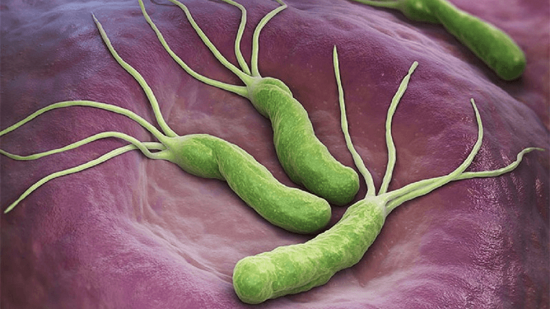 loét dạ dày điều trị