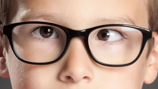 Mắt bị lé 1 bên và những thông tin liên quan