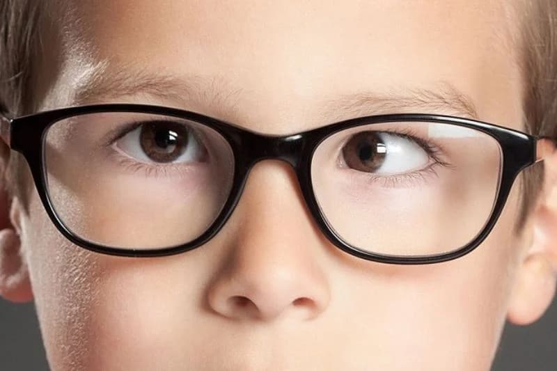 Mắt lé 1 bên có thể xuất hiện ở cả trẻ em và người lớn, với các nguyên nhân và mức độ khác nhau.