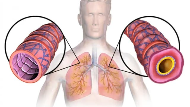 Những điều cần biết về suy hô hấp độ 2