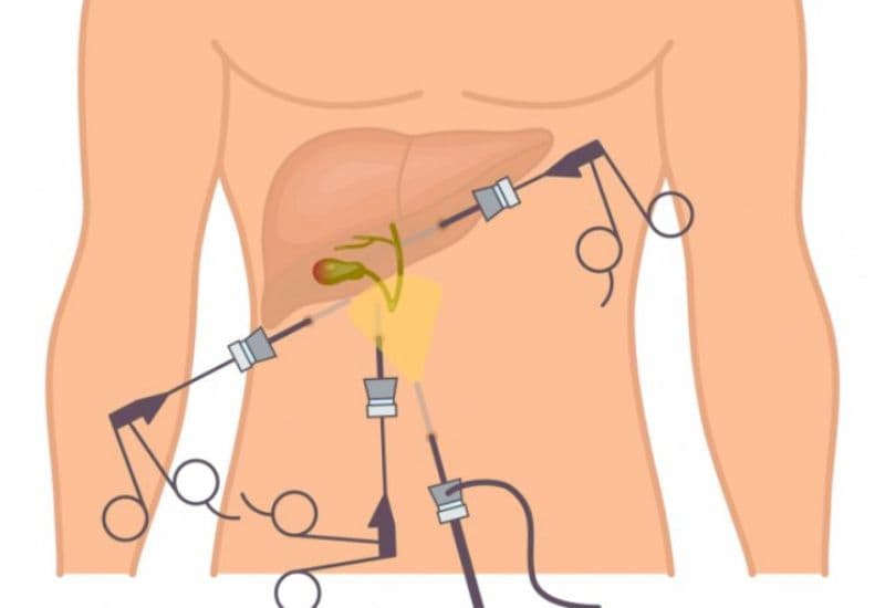 Phương pháp điều trị hiện đại giúp giảm thiểu đau đớn và rút ngắn thời gian hồi phục