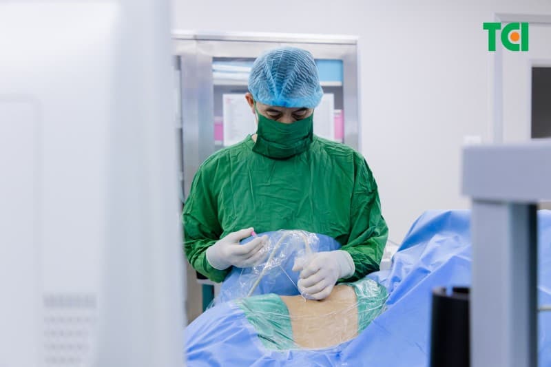 Quy trình thực hiện kỹ thuật tán sỏi qua da