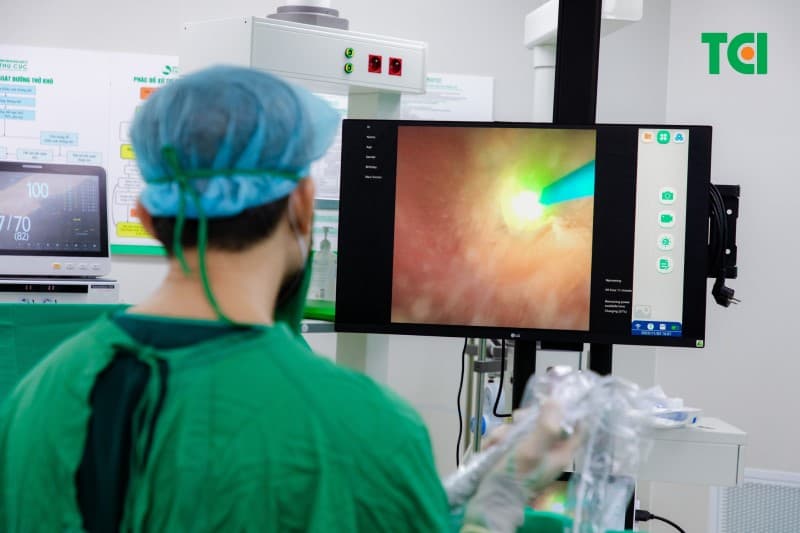 Thực hiện tán sỏi nội soi niệu quản ống mềm