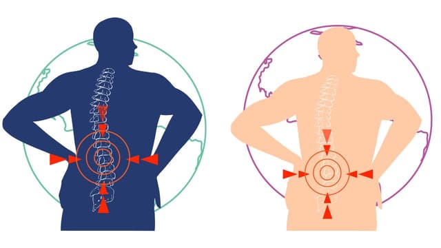 Cách điều trị trong trường hợp thoát vị đĩa đệm nhẹ