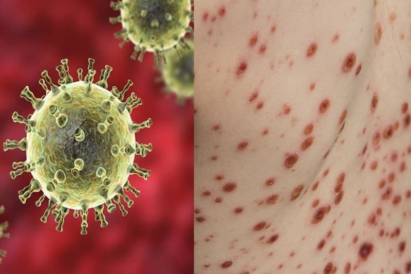 thủy đậu nên ăn gì - vius thủy đậu