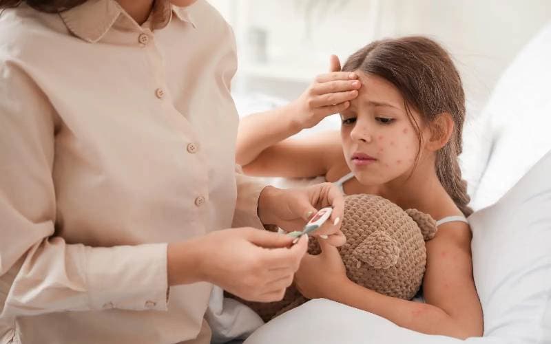 Các Triệu chứng của bệnh thủy đậu