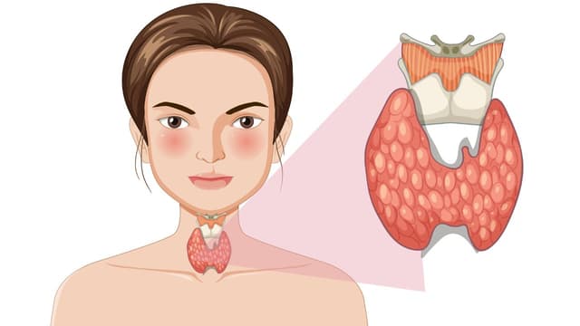 Triệu chứng cường giáp trên lâm sàng và chẩn đoán y khoa