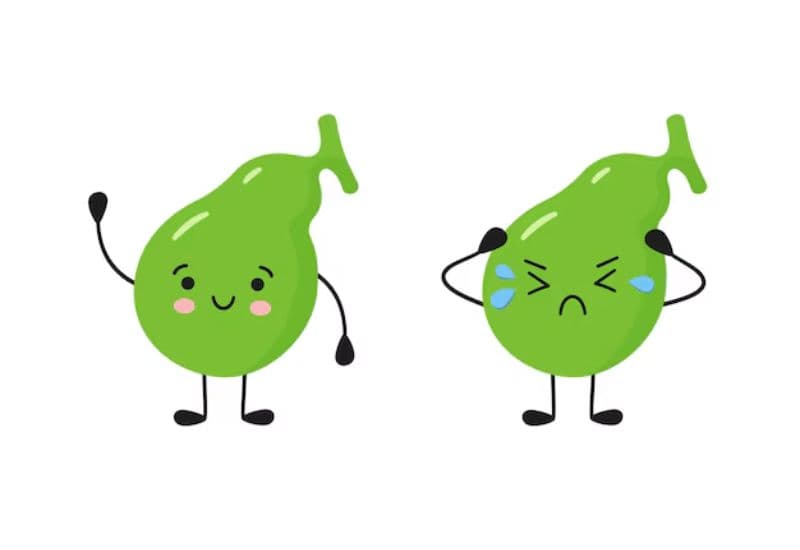 Viêm túi mật do sỏi: Cơ chế bệnh sinh và triệu chứng đặc trưng