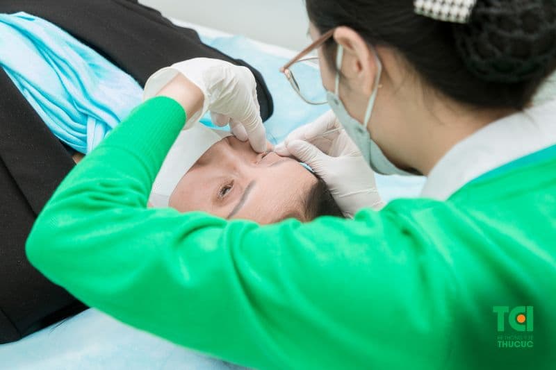 viêm tuyến bờ mi